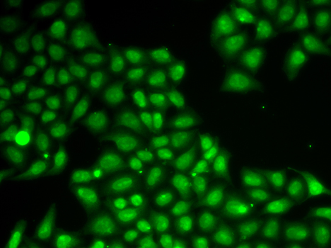 FEN1 Antibody - Immunofluorescence analysis of A549 cells using FEN1 antibody.