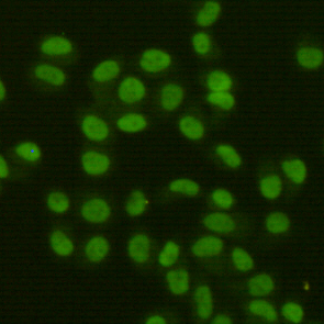 FEN1 Antibody - Immunocytochemistry staining of HeLa cells fixed with 4% Paraformaldehyde and using FEN-1 mouse monoclonal antibody (dilution 1:400).