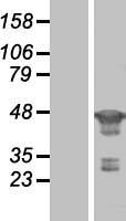 FEN1 Protein - Western validation with an anti-DDK antibody * L: Control HEK293 lysate R: Over-expression lysate