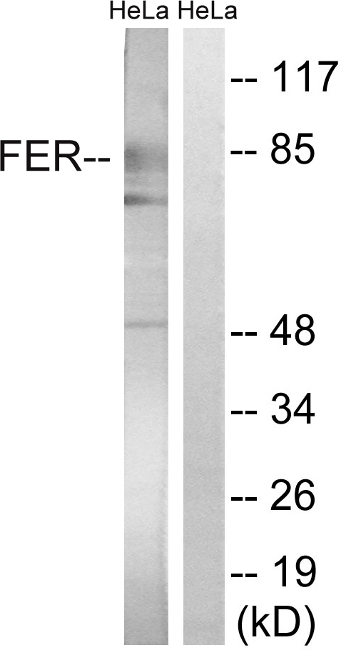 FER Antibody - Western blot analysis of lysates from HeLa cells treated with paclitaxel 1uM 24h, using FER Antibody. The lane on the right is blocked with the synthesized peptide.