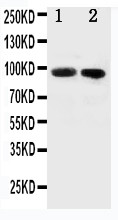 FER Antibody - WB of FER antibody. All lanes: Anti-FER at 0.5ug/ml. Lane 1: Rat Testis Tissue Lysate at 40ug. Lane 2: Rat Ovary Tissue Lysate at 40ug. Predicted bind size: 95KD. Observed bind size: 95KD.