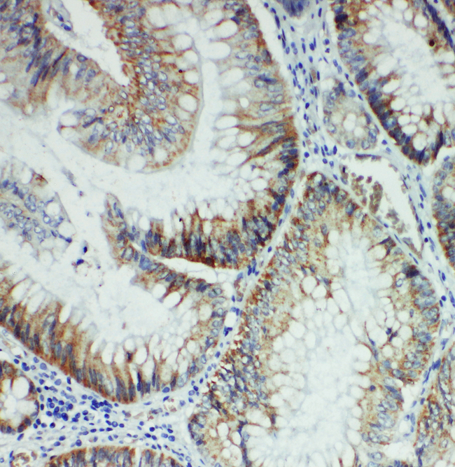 FER Antibody - FER antibody. IHC(P): Rat Intestine Tissue.