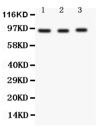 FER Antibody - Anti-FER antibody, Western blotting All lanes: Anti FER at 0.5ug/ml Lane 1: HELA Whole Cell Lysate at 40ugLane 2: Rat Testis Tissue Lysate at 50ugLane 3: Rat Ovary Tissue Lysate at 50ugPredicted bind size: 95KD Observed bind size: 95KD
