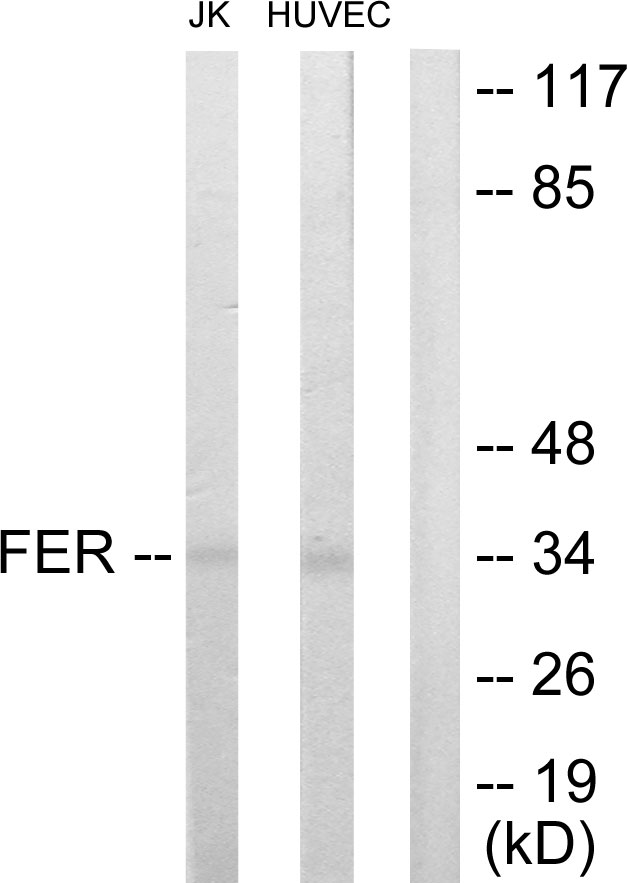 FER Antibody - Western blot analysis of lysates from Jurkat and HUVEC cells, using FER Antibody. The lane on the right is blocked with the synthesized peptide.