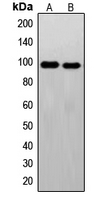 FER Antibody - Western blot analysis of c-FER expression in Jurkat (A); HeLa (B) whole cell lysates.