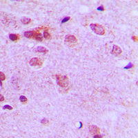 FER Antibody - Immunohistochemical analysis of c-FER staining in human brain formalin fixed paraffin embedded tissue section. The section was pre-treated using heat mediated antigen retrieval with sodium citrate buffer (pH 6.0). The section was then incubated with the antibody at room temperature and detected using an HRP conjugated compact polymer system. DAB was used as the chromogen. The section was then counterstained with hematoxylin and mounted with DPX.