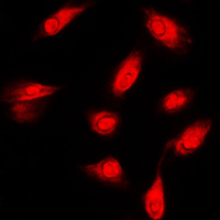 FER Antibody - Immunofluorescent analysis of c-FER staining in HeLa cells. Formalin-fixed cells were permeabilized with 0.1% Triton X-100 in TBS for 5-10 minutes and blocked with 3% BSA-PBS for 30 minutes at room temperature. Cells were probed with the primary antibody in 3% BSA-PBS and incubated overnight at 4 C in a humidified chamber. Cells were washed with PBST and incubated with a DyLight 594-conjugated secondary antibody (red) in PBS at room temperature in the dark. DAPI was used to stain the cell nuclei (blue).