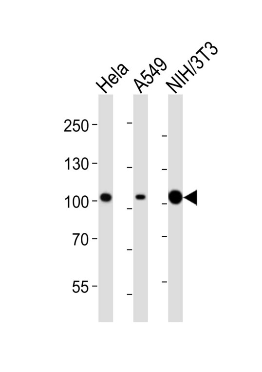 FER Antibody - Western blot of lysates from HeLa, A549, mouse NIH/3T3 cell line (from left to right), using FER antibody diluted at 1:2000 at each lane. A goat anti-mouse IgG H&L (HRP) at 1:3000 dilution was used as the secondary antibody. Lysates at 20 ug per lane.