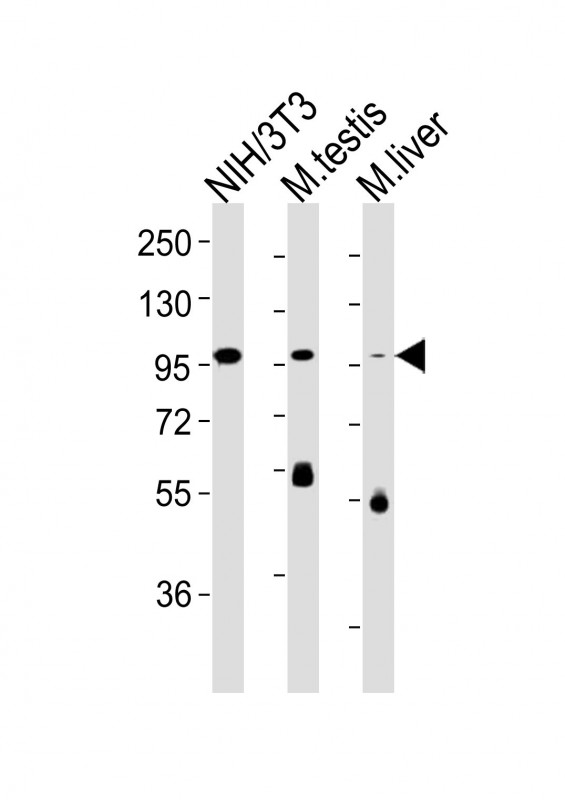 FER Antibody - All lanes : Anti-Fer Antibody at 1:4000 dilution Lane 1: NIH/3T3 whole cell lysates Lane 2: mouse testis lysates Lane 3: mouse liver lysates Lysates/proteins at 20 ug per lane. Secondary Goat Anti-Rabbit IgG, (H+L), Peroxidase conjugated at 1/10000 dilution Predicted band size : 95 kDa Blocking/Dilution buffer: 5% NFDM/TBST.