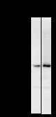 FER Antibody - Detection of FER by Western blot. Samples: Whole cell lysate from human HeLa (H, 25 ug) and mouse NIH3T3 (M, 25 ug) cells. Predicted molecular weight: 94 kDa