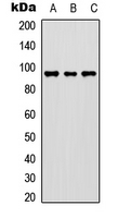 FER Antibody - Western blot analysis of c-FER expression in HEK293T (A); HeLa (B); NIH3T3 (C) whole cell lysates.
