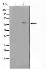 FER Antibody - Western blot of Jurkat cell lysate using FER Antibody