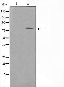 FER Antibody - Western blot analysis on Jurkat cell lysates using FER antibody. The lane on the left is treated with the antigen-specific peptide.