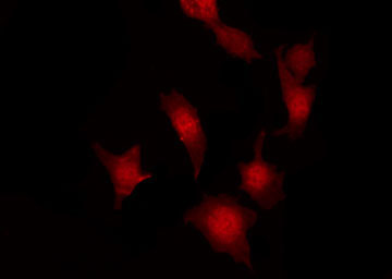 FER Antibody - Staining HeLa cells by IF/ICC. The samples were fixed with PFA and permeabilized in 0.1% Triton X-100, then blocked in 10% serum for 45 min at 25°C. The primary antibody was diluted at 1:200 and incubated with the sample for 1 hour at 37°C. An Alexa Fluor 594 conjugated goat anti-rabbit IgG (H+L) Ab, diluted at 1/600, was used as the secondary antibody.