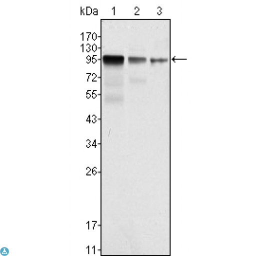FER Antibody - Confocal Immunofluorescence (IF) analysis of HeLa cells using Fer Monoclonal Antibody (green). Red: Actin filaments have been labeled with Alexa Fluor-555 phalloidin. Blue: DRAQ5 fluorescent DNA dye.