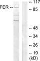 FER Antibody - Western blot analysis of extracts from HeLa cells, using FER antibody.