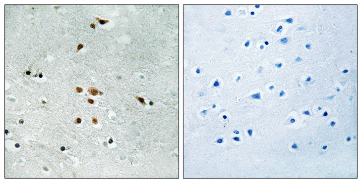 FER Antibody - Immunohistochemistry analysis of paraffin-embedded human brain, using FER (Phospho-Tyr402) Antibody. The picture on the right is blocked with the phospho peptide.