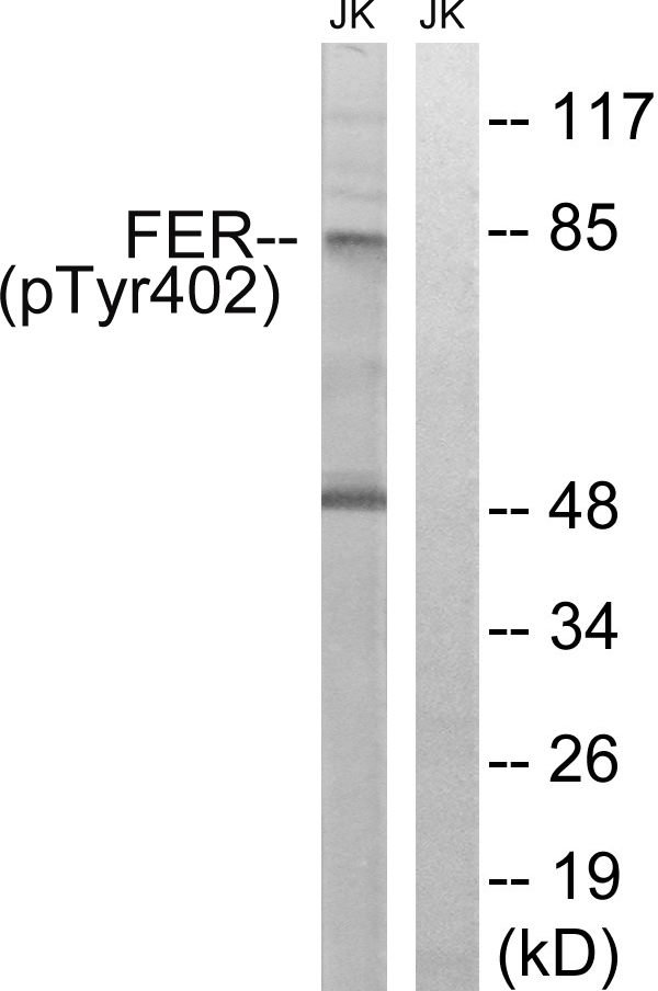 FER Antibody - Western blot analysis of lysates from Jurkat cells treated with starved 24h, using FER (Phospho-Tyr402) Antibody. The lane on the right is blocked with the phospho peptide.