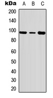 FER Antibody - Western blot analysis of c-FER (pY402) expression in HeLa (A); Jurkat (B); NIH3T3 (C) whole cell lysates.