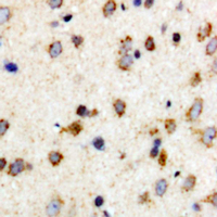 FER Antibody - Immunohistochemical analysis of c-FER (pY402) staining in human brain formalin fixed paraffin embedded tissue section. The section was pre-treated using heat mediated antigen retrieval with sodium citrate buffer (pH 6.0). The section was then incubated with the antibody at room temperature and detected using an HRP conjugated compact polymer system. DAB was used as the chromogen. The section was then counterstained with hematoxylin and mounted with DPX.