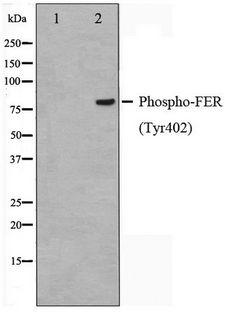 FER Antibody - Western blot of Jurkat cell lysate using Phospho-FER(Tyr402) Antibody