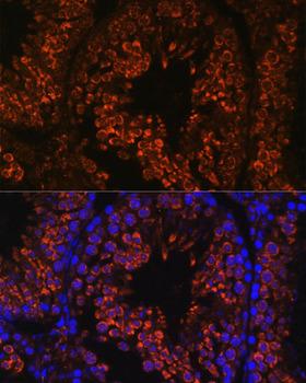 FER1L5 Antibody - Immunofluorescence analysis of Mouse testis using FER1L5 Polyclonal Antibody at dilution of 1:100.Blue: DAPI for nuclear staining.
