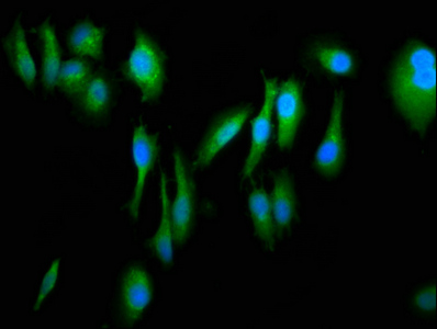 FERMT1 / Kindlin Antibody - Immunofluorescence staining of Hela cells at a dilution of 1:266, counter-stained with DAPI. The cells were fixed in 4% formaldehyde, permeabilized using 0.2% Triton X-100 and blocked in 10% normal Goat Serum. The cells were then incubated with the antibody overnight at 4 °C.The secondary antibody was Alexa Fluor 488-congugated AffiniPure Goat Anti-Rabbit IgG (H+L) .