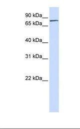 FERMT1 / Kindlin Antibody - Fetal heart lysate. Antibody concentration: 1.0 ug/ml. Gel concentration: 12%.  This image was taken for the unconjugated form of this product. Other forms have not been tested.
