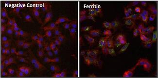 Ferritin Antibody - Immunofluorescent analysis of Ferritin (FTL, green) in HepG2 cells and MCF7 cells. The cells were fixed with formalin for 15 minutes, permeabilized with 0.1% Triton X-100 in TBS for 10 minutes, and blocked with 1% Blocker BSA for 15 minutes at room temperature. Cells were stained with a Ferritin monoclonal antibody, at a dilution of 1:200 for at least 1 hour at room temperature, and then incubated with a DyLight 488 goat anti-mouse secondary antibody at a dilution of 1:500 for 30 minutes at room temperature (both panels, green). F-Actin (both panels, red) was stained with DyLight 554 Phalloidin and nuclei (both panels, blue) were stained with Hoechst 33342 dye. Images were taken on a Thermo Scientific ToxInsight at 20X magnification.