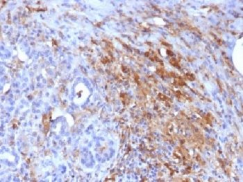 Ferritin Antibody - IHC testing of FFPE human pancreas with Ferritin Light Chain antibody (clone FTL/1386). Required HIER: boil tissue sections in 10mM citrate buffer, pH 6, for 10-20 min.