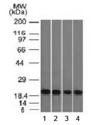 Ferritin Antibody - Western blot testing of human 1) A431, 2) HeLa, 3) liver and 4) testis lysate with Ferritin Light Chain antibody (clone FTL/1386).