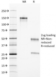 Ferritin Antibody - SDS-PAGE Analysis of Purified, BSA-Free Ferritin Light Chain Antibody (clone FTL/1389). Confirmation of Integrity and Purity of the Antibody.