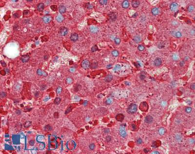 Ferritin Antibody - Human Liver: Formalin-Fixed, Paraffin-Embedded (FFPE)