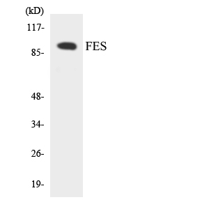 FES Antibody - Western blot analysis of the lysates from HUVECcells using FES antibody.
