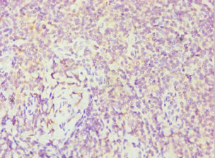 FES Antibody - Immunohistochemistry of paraffin-embedded human tonsil tissue using FES Antibody at dilution of 1:100