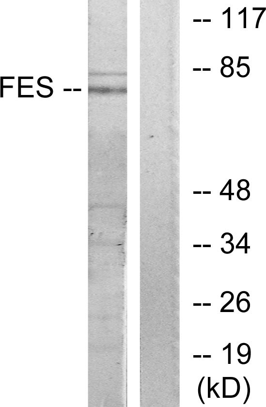 FES Antibody - Western blot analysis of lysates from HUVEC cells, treated with serum 20% 30', using FES Antibody. The lane on the right is blocked with the synthesized peptide.