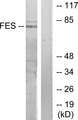 FES Antibody - Western blot analysis of lysates from HUVEC cells, treated with serum 20% 30', using FES Antibody. The lane on the right is blocked with the synthesized peptide.