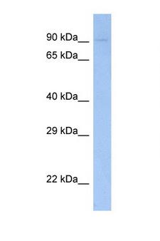 FES Antibody - FES antibody Western blot of Fetal Muscle lysate. Antibody concentration 1 ug/ml.  This image was taken for the unconjugated form of this product. Other forms have not been tested.