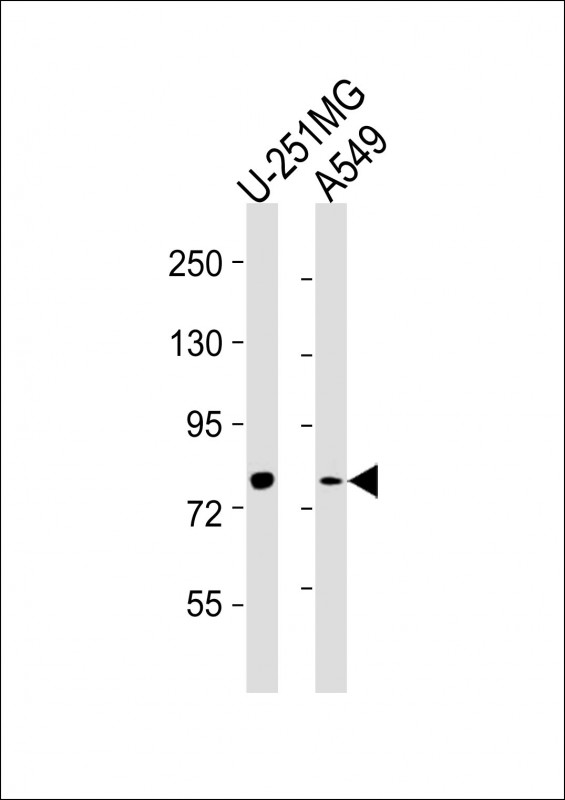 FES Antibody - All lanes : Anti-FES Antibody at 1:2000 dilution Lane 1: U-251MG whole cell lysates Lane 2: A549 whole cell lysates Lysates/proteins at 20 ug per lane. Secondary Goat Anti-Rabbit IgG, (H+L), Peroxidase conjugated at 1/10000 dilution Predicted band size : 93 kDa Blocking/Dilution buffer: 5% NFDM/TBST.