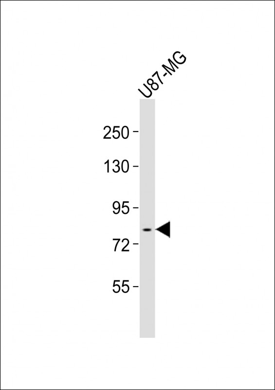 FES Antibody - Anti-FES Antibody at 1:1000 dilution + U87-MG whole cell lysates Lysates/proteins at 20 ug per lane. Secondary Goat Anti-Rabbit IgG, (H+L), Peroxidase conjugated at 1/10000 dilution Predicted band size : 93 kDa Blocking/Dilution buffer: 5% NFDM/TBST.