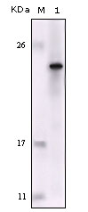FES Antibody - Western blot using FES mouse monoclonal antibody against truncated FES recombinant protein.