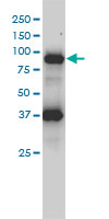 FES Antibody - FES monoclonal antibody (M01), clone 3A3-1E5 Western Blot analysis of FES expression in HL-60.