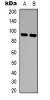 FES Antibody - Western blot analysis of c-FER expression in TF1 (A); A549 (B) whole cell lysates.