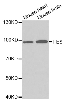 FES Antibody - Western blot analysis of extracts of various cell lines.