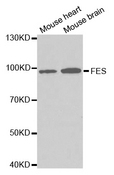 FES Antibody - Western blot analysis of extracts of various cell lines.