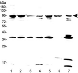 FES Antibody - Western blot testing of human 1) HeLa, 2) 293T, 3) SKOV3, 4) A549, 5) MCF7, 6) placenta and 7) PANC-1 lysate with FES antibody at 0.5ug/ml. Predicted molecular weight ~93 kDa.