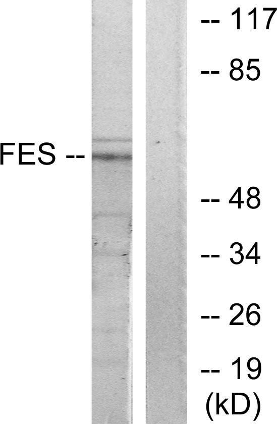 FES Antibody - Western blot analysis of extracts from HUVEC cells, treated with serum (20%, 30mins), using FES antibody.