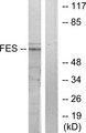 FES Antibody - Western blot analysis of extracts from HUVEC cells, treated with serum (20%, 30mins), using FES antibody.