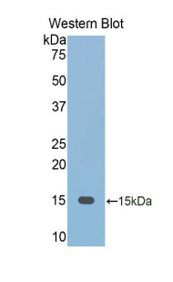 FETUB / Fetuin B Antibody - Western blot of recombinant FETUB / Fetuin B.  This image was taken for the unconjugated form of this product. Other forms have not been tested.