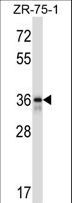FETUB / Fetuin B Antibody - FETUB Antibody western blot of ZR-75-1 cell line lysates (35 ug/lane). The FETUB antibody detected the FETUB protein (arrow).